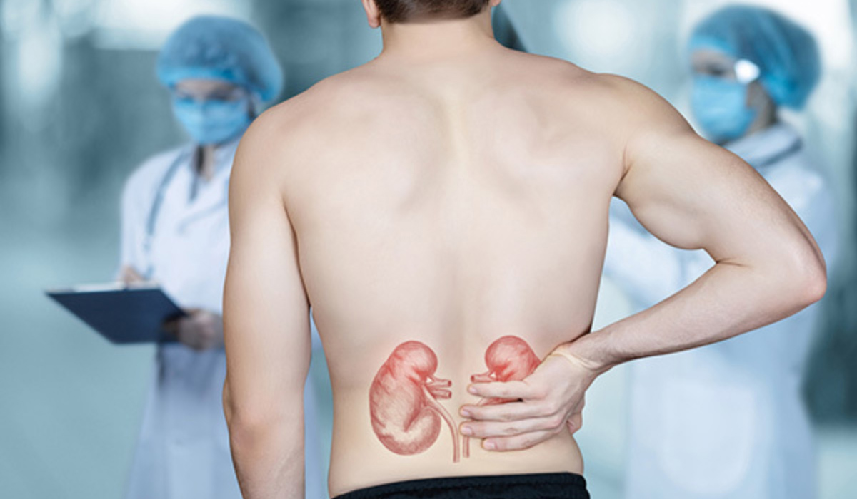 Kidney cancer